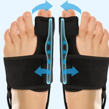 Cierpisz z powodu bolesnego haluksa? Uśmierz ból bez operacji – wystarczy 20 minut dziennie!